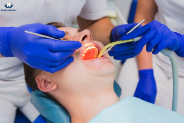 Tooth Extraction Process: What to Expect Before, During, and After