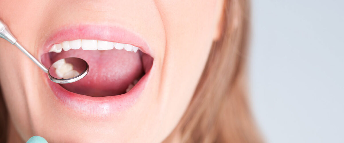 white-fillings-banner