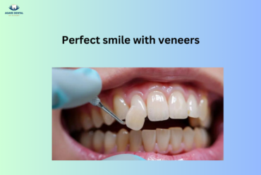 Are Veneers Right for You? Pros, Cons, and What to Consider